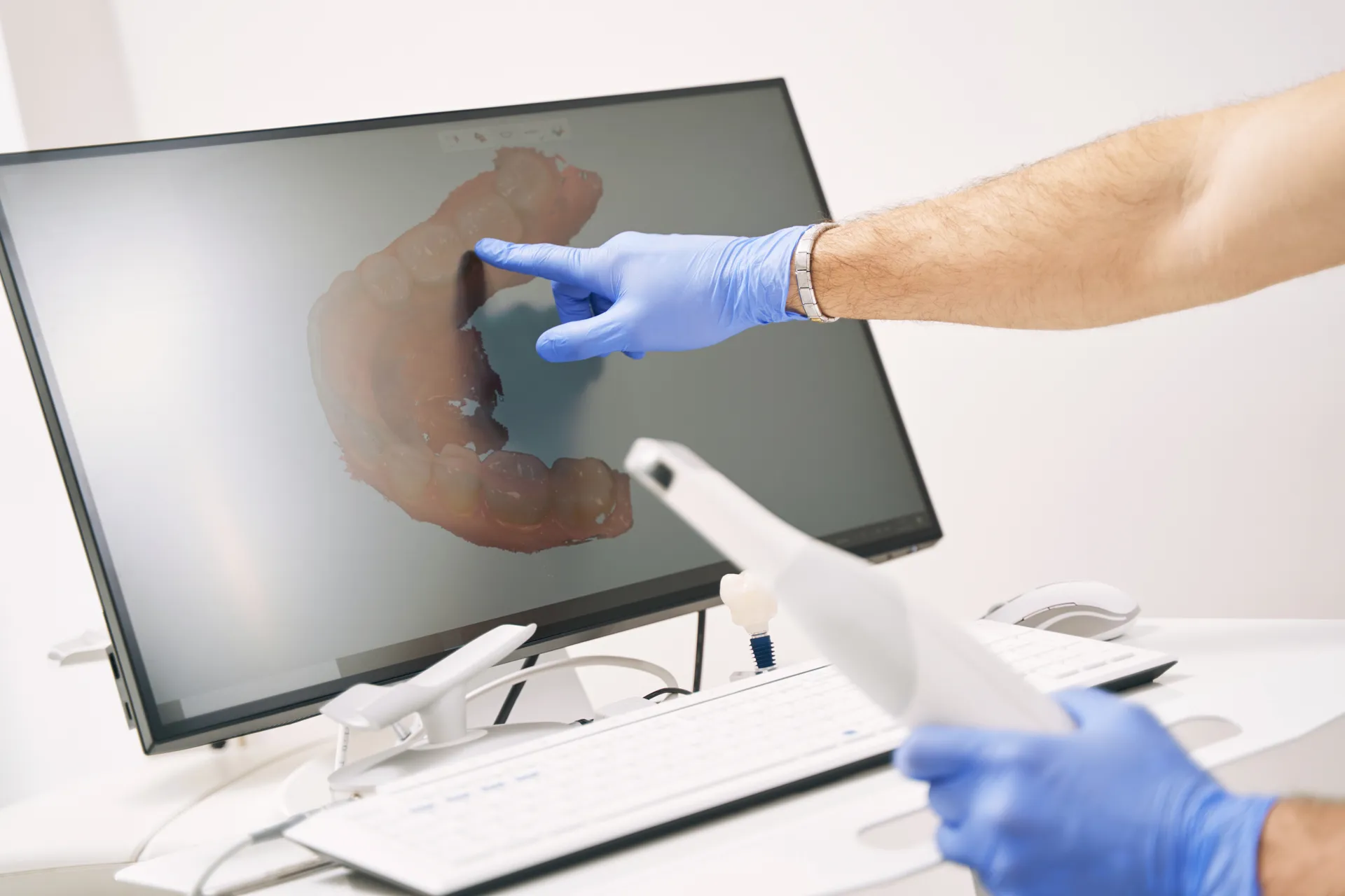 A dentist pointing to a digital 3D scan of a patient's teeth on a monitor