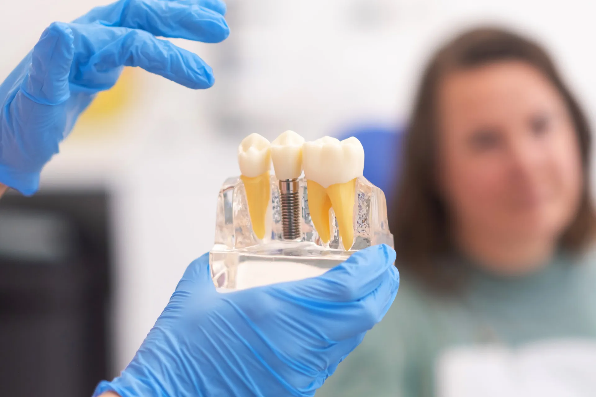 Close Up Of Dental Model With Implant Patient Of 2023 11 27 04 58 01 Utc at Magical Smiles Caroline Springs