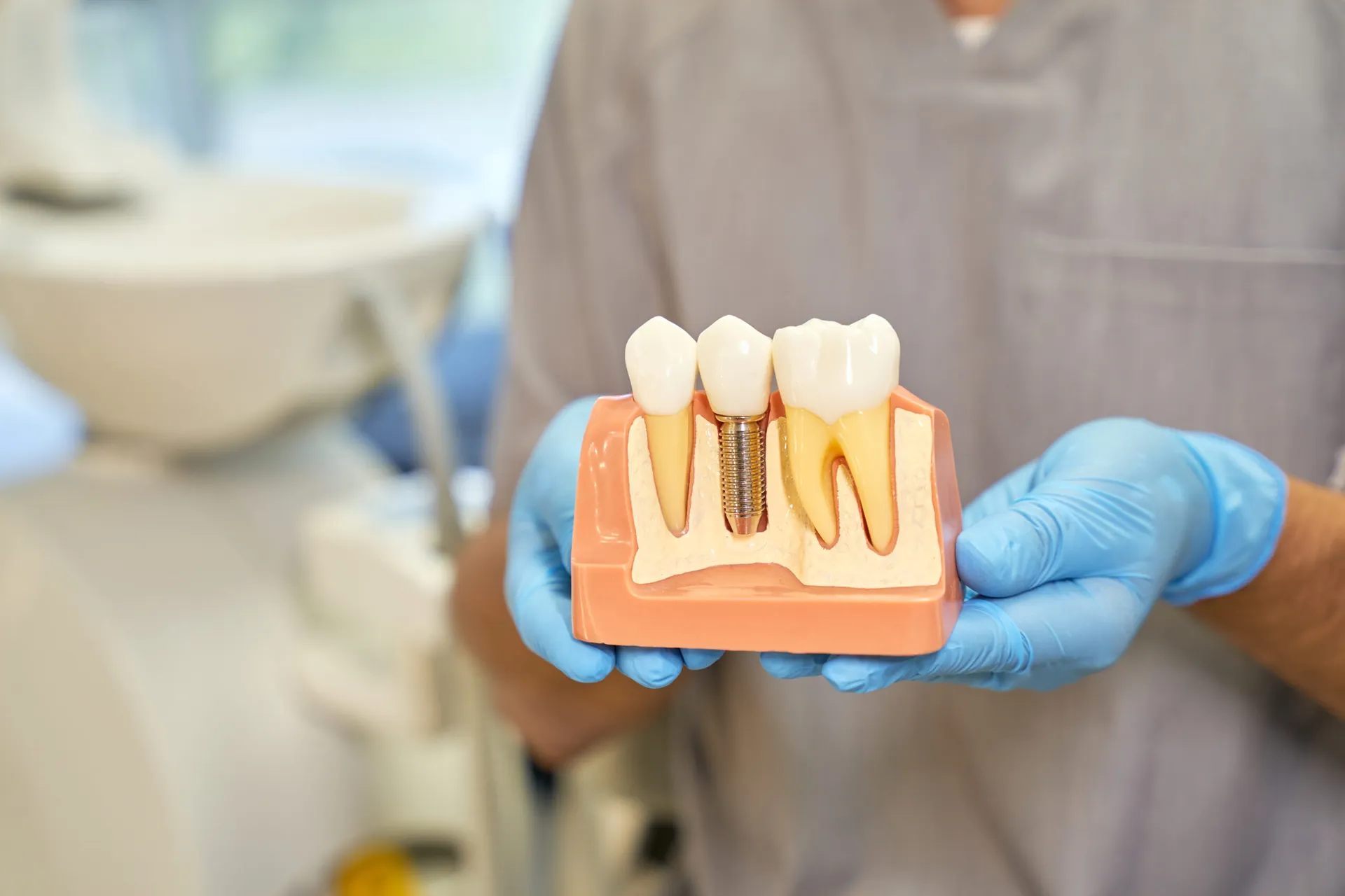 Cropped Shot Of Dental Implant Model In Hands Of D 2023 11 27 05 15 34 Utc at Magical Smiles Caroline Springs
