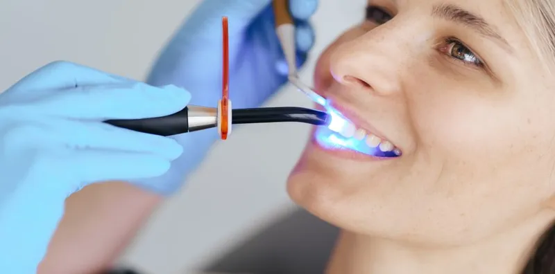 What Is Laser Dentistry 1 at Magical Smiles Caroline Springs