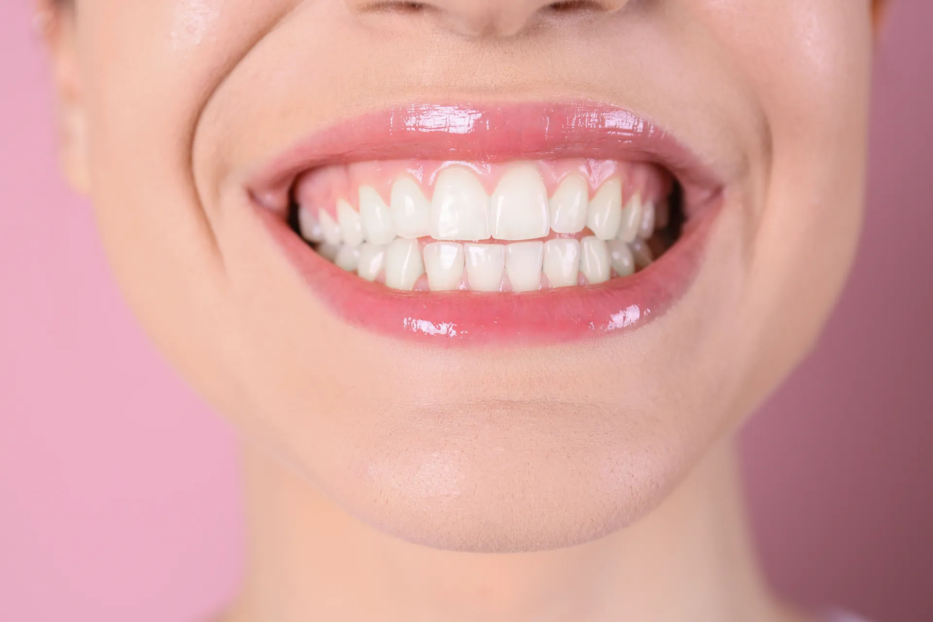 Bright, healthy smile after cosmetic dentistry
