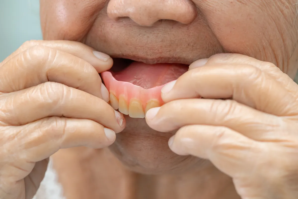 A senior patient holding her immediate denture, ready to use