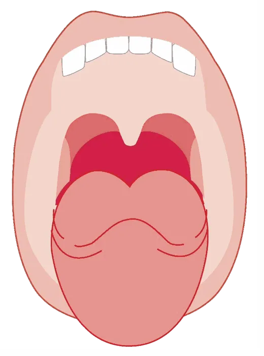 Diagram of an open mouth showing the soft palate and tonsillar area at the back of the throat, highlighted in red.