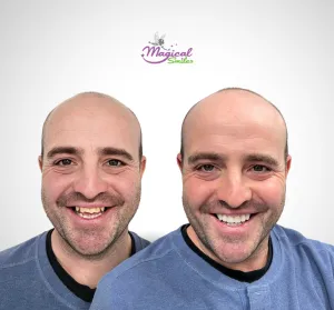 Restoration, before and after