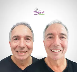 Restoration, before and after