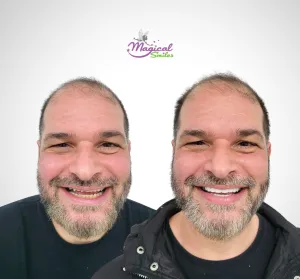 Cosmetic dentistry, before and after
