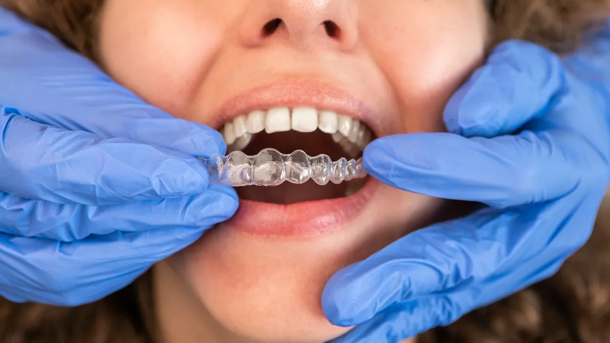 A dentist in gloves fitting a clear aligner tray over a patient's teeth