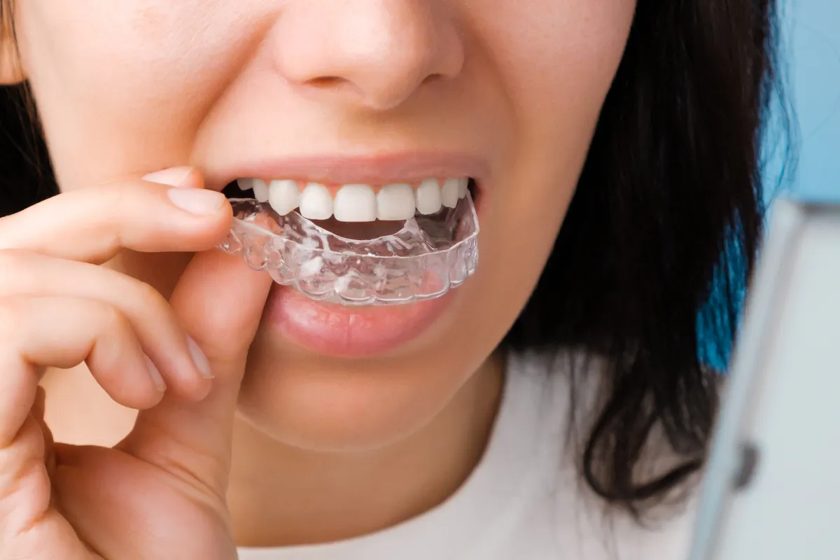 A smiling woman inserting a clear aligner tray over her teeth