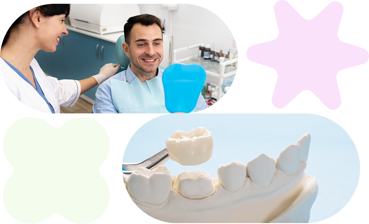 dental crown service