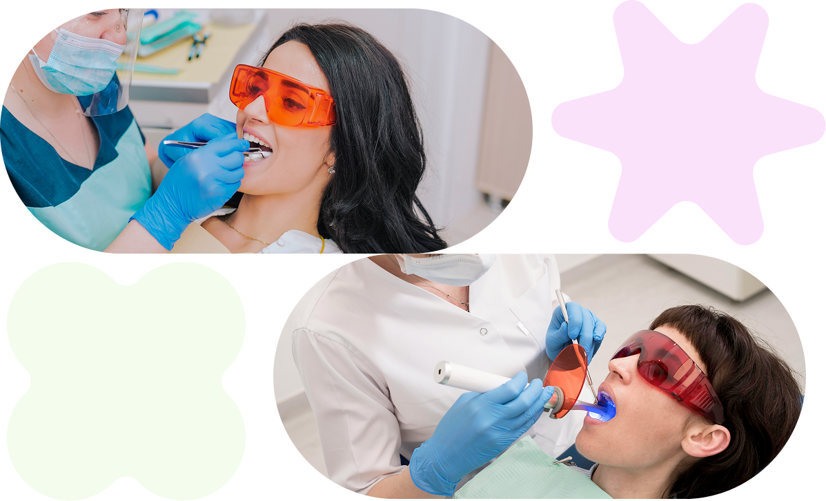 dental fillings services