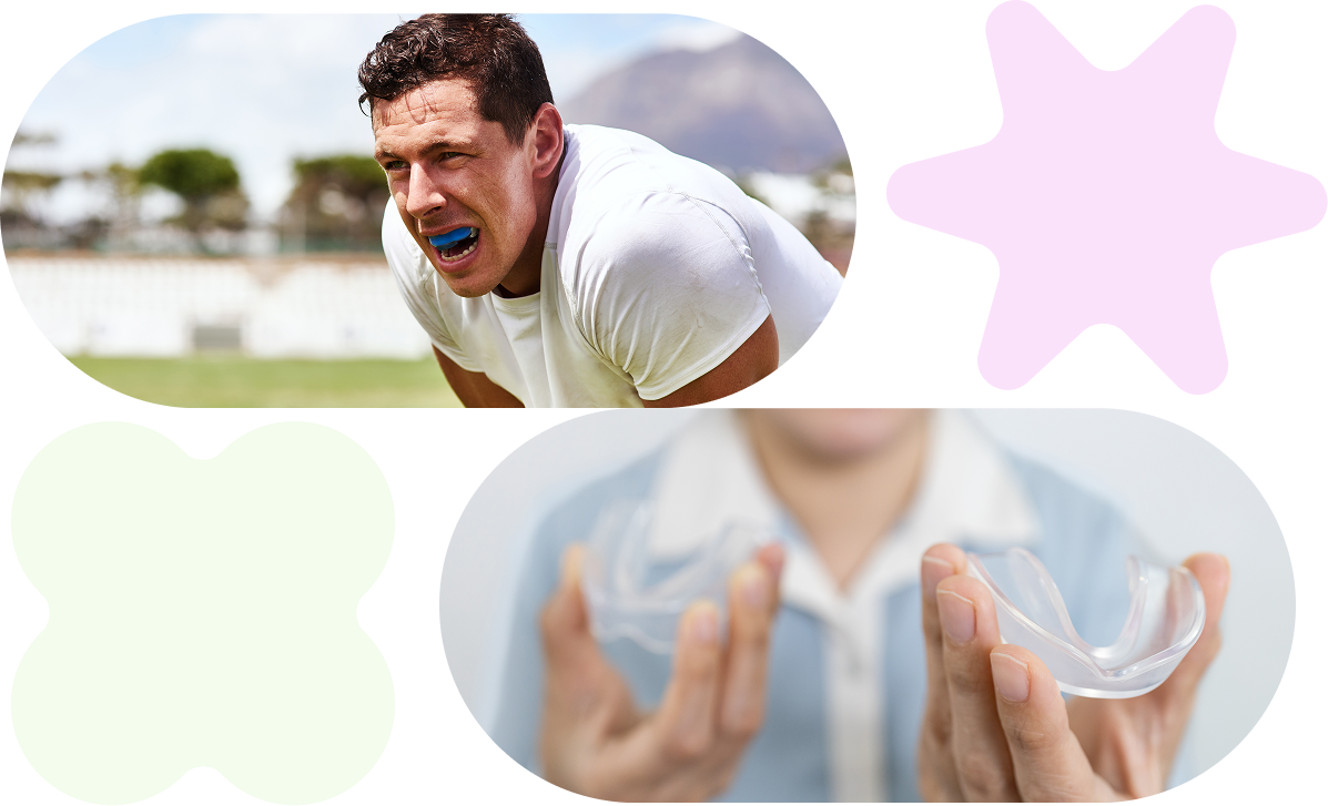 mouthguards services