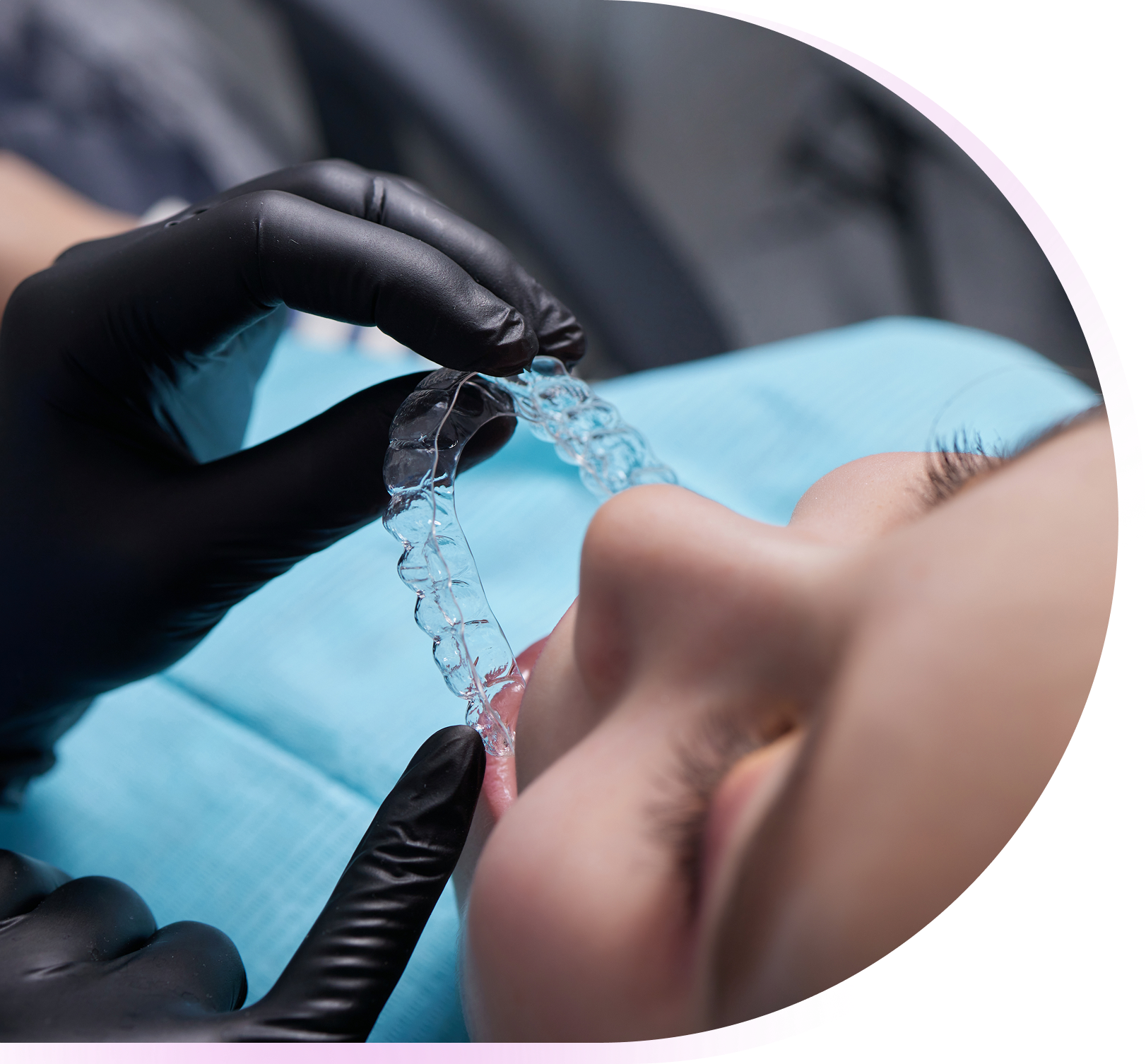 candidate invisalign