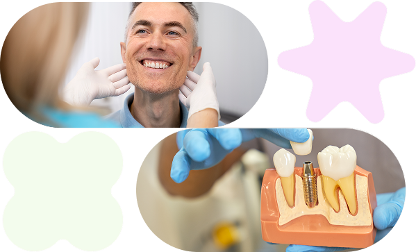 single implant services