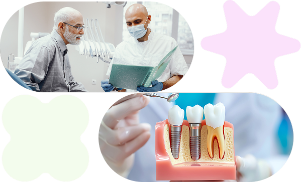 multiple implant services