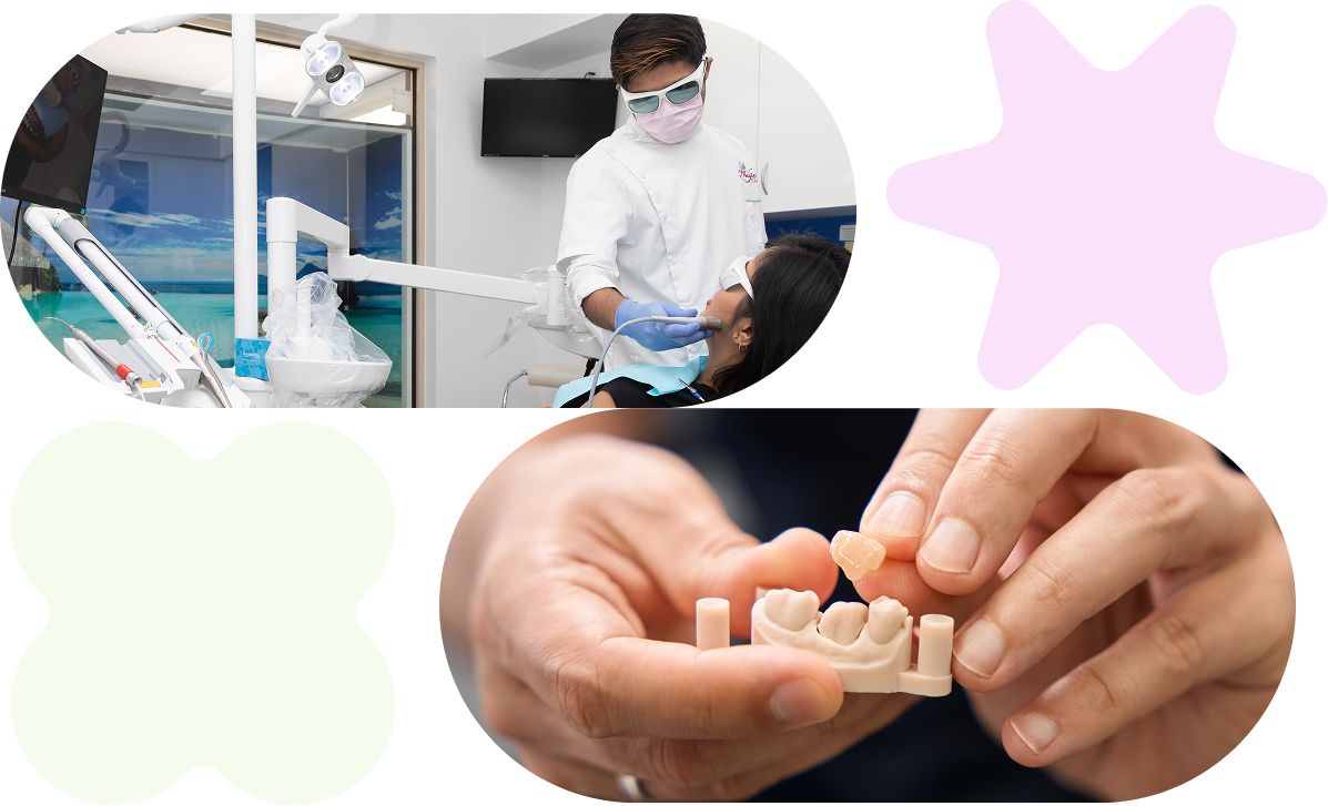 why choose crowns bridges 3