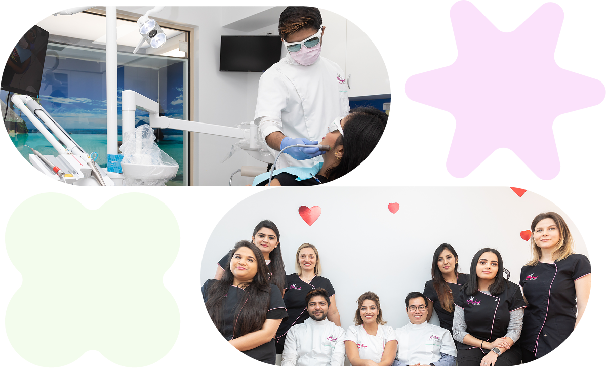 why choose laser whitening 2