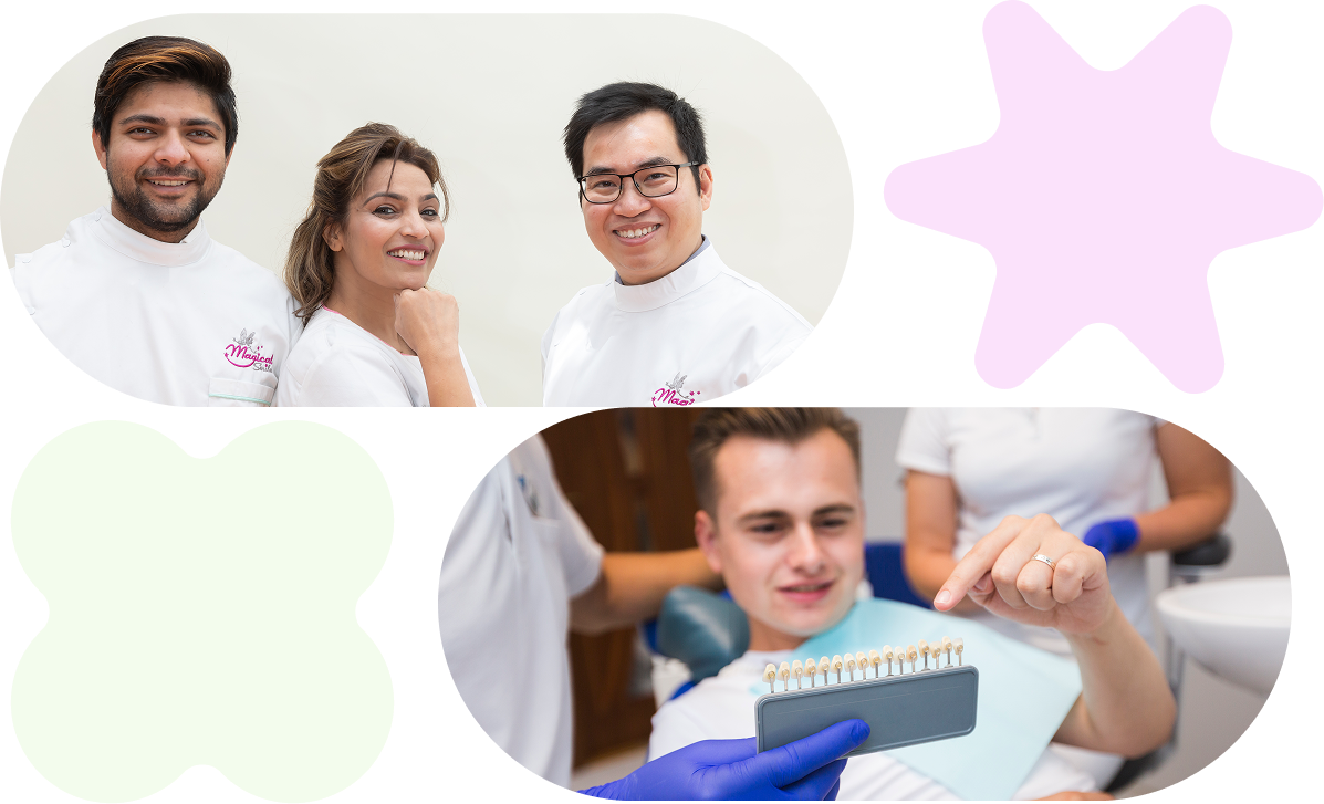 why choose veneers 2